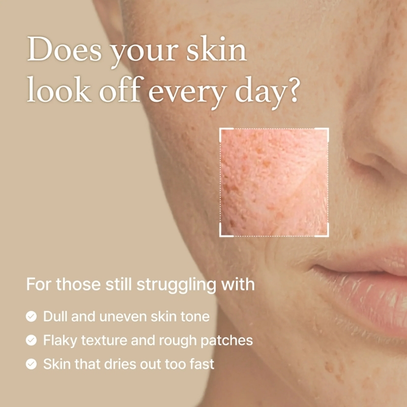 I'm from Rice Toner, 77.78% Rice Extract from Korea, Glow Essence with Niacinamide, Hydrating for Dry Skin, Vegan, Alcohol Free, Fragrance Free cyprus korean cosmetics