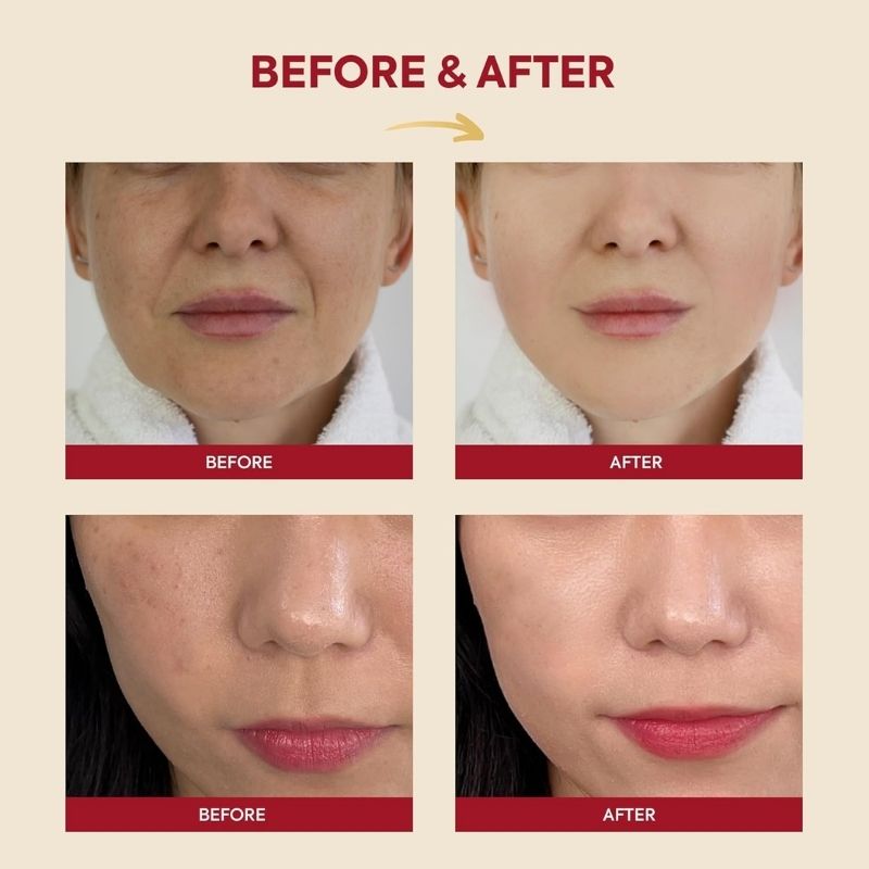 K-SECRET SEOUL 1988 ESSENCE : SNAIL MUCIN 97% + RICE