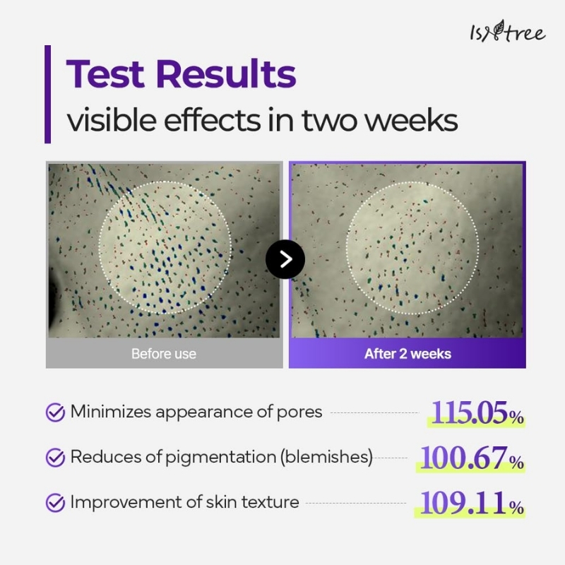 ISNTREE Onion Newpair Booster 2000s 1.69 fl.oz | Spicule Microneedling Facial Serum | Panthenol, Hyaluronic Acid, Collagen, Cica | Pore Care, Pigmentation, Skin Texture | Korean Skin Care