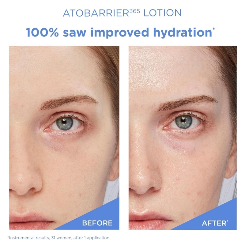 AESTURA ATOBARRIER365 Lightweight Korean Face Moisturizer with Ceramides | Strengthens Barrier, Fast-Absorbing Hydration, Suitable for Dry, Normal & Sensitive Skin, 150ML