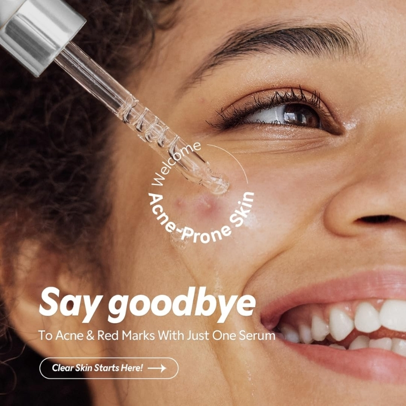 TIRTIR - Azelaic Acid 12% Serum 30ml