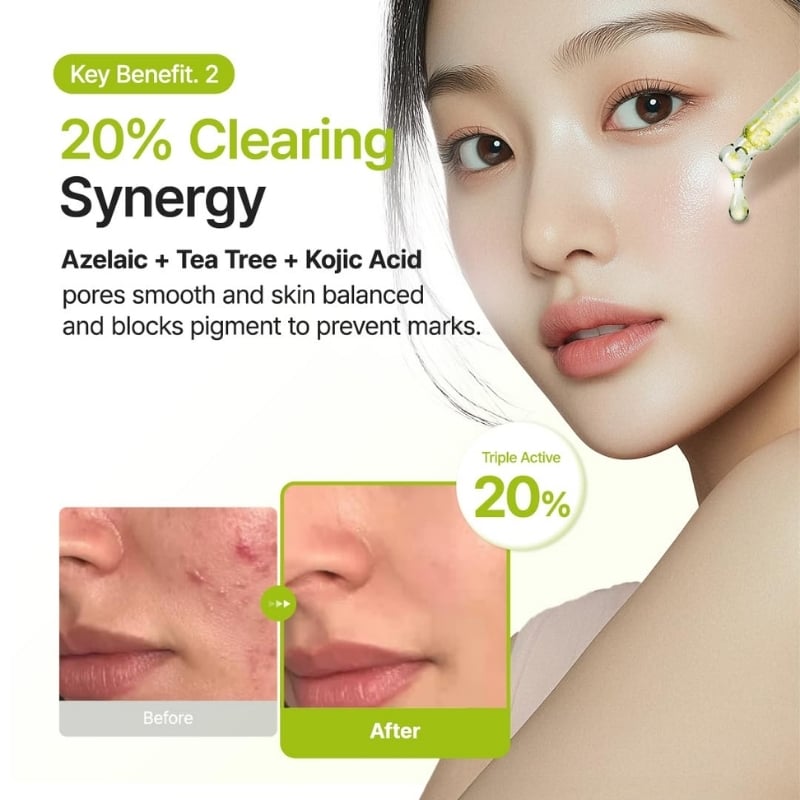 Purito SEOUL Azelaic Acid 10 Kojic Tea Tree Serum
