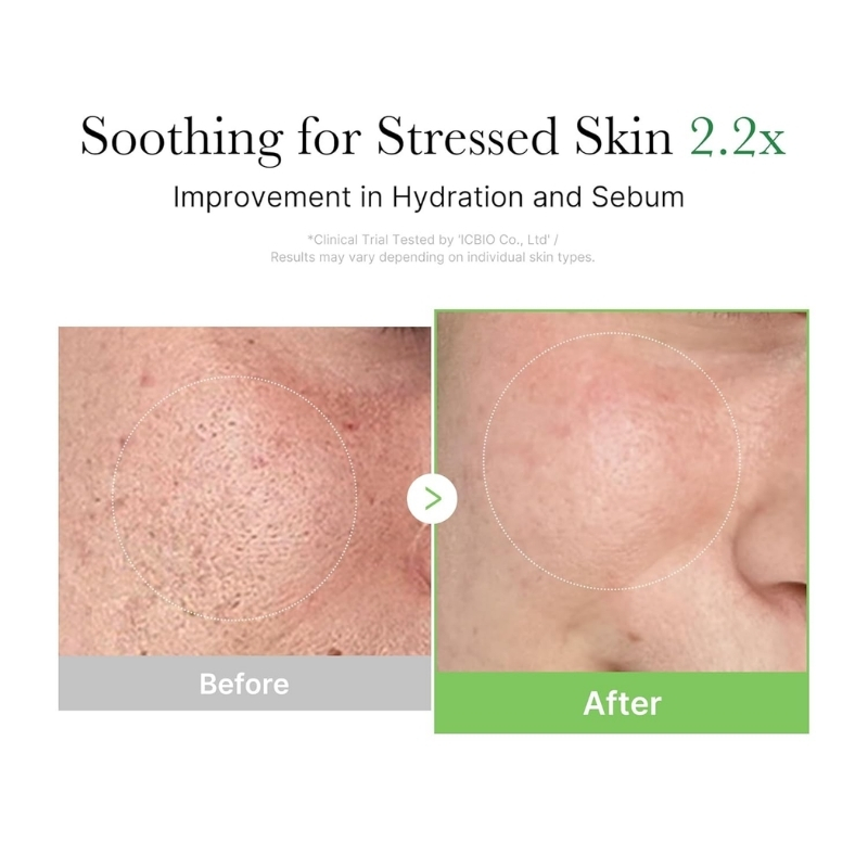 Medicube - Exosome Cica Calming Cream 50ml - Image 5