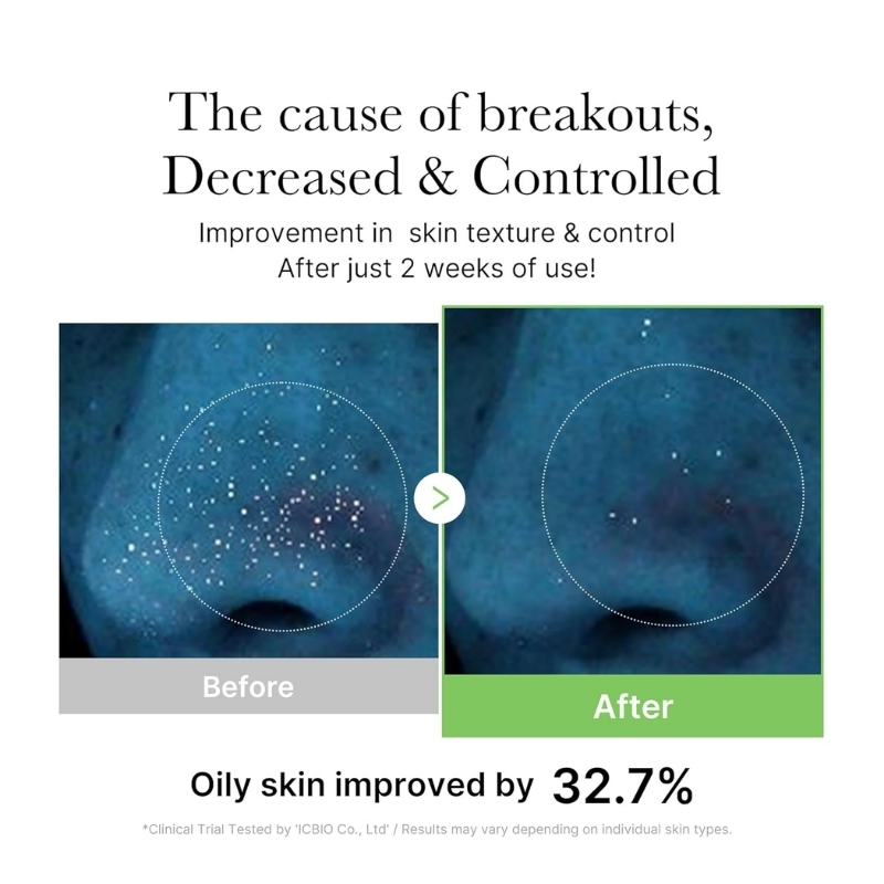 Medicube - Exosome Cica Calming Toner 210ml - Image 4