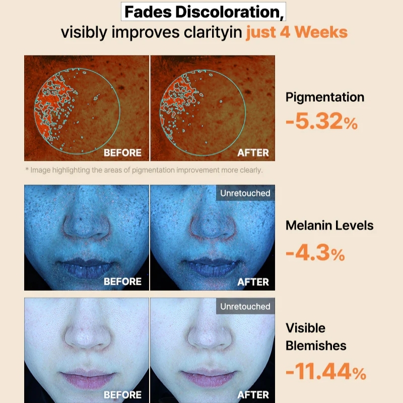 Cosrx - The Alpha-Arbutin Discoloration Care Hydrogel Mask (3pcs) - Image 8