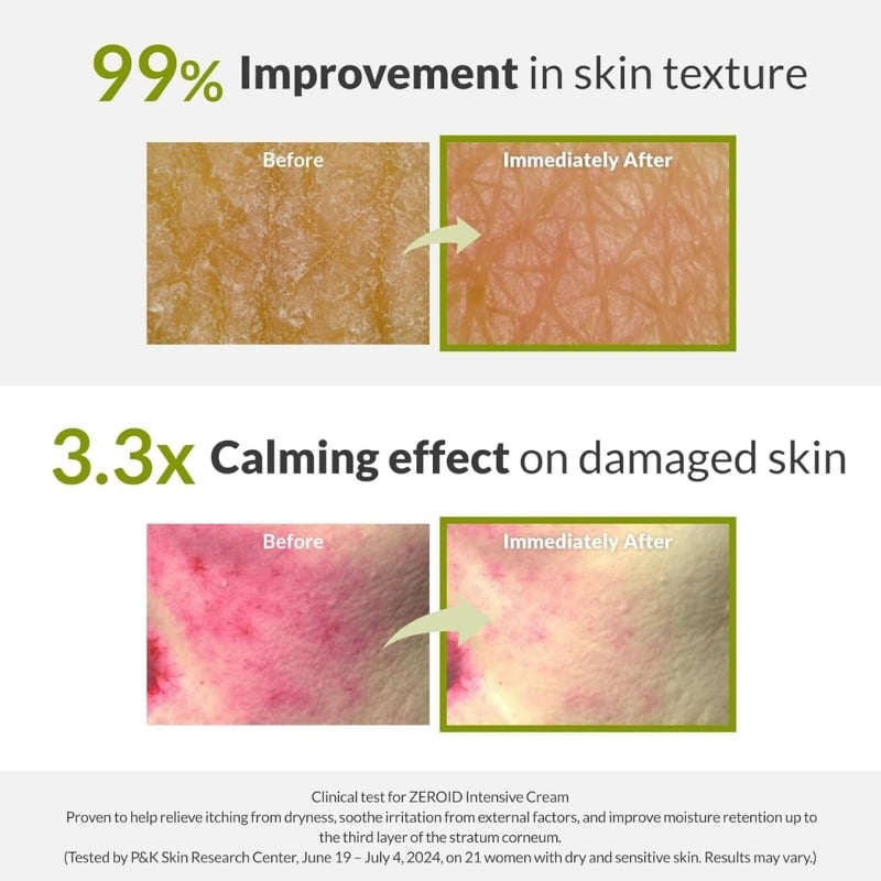 Zeroid - Intensive Cream 80ml - Image 5