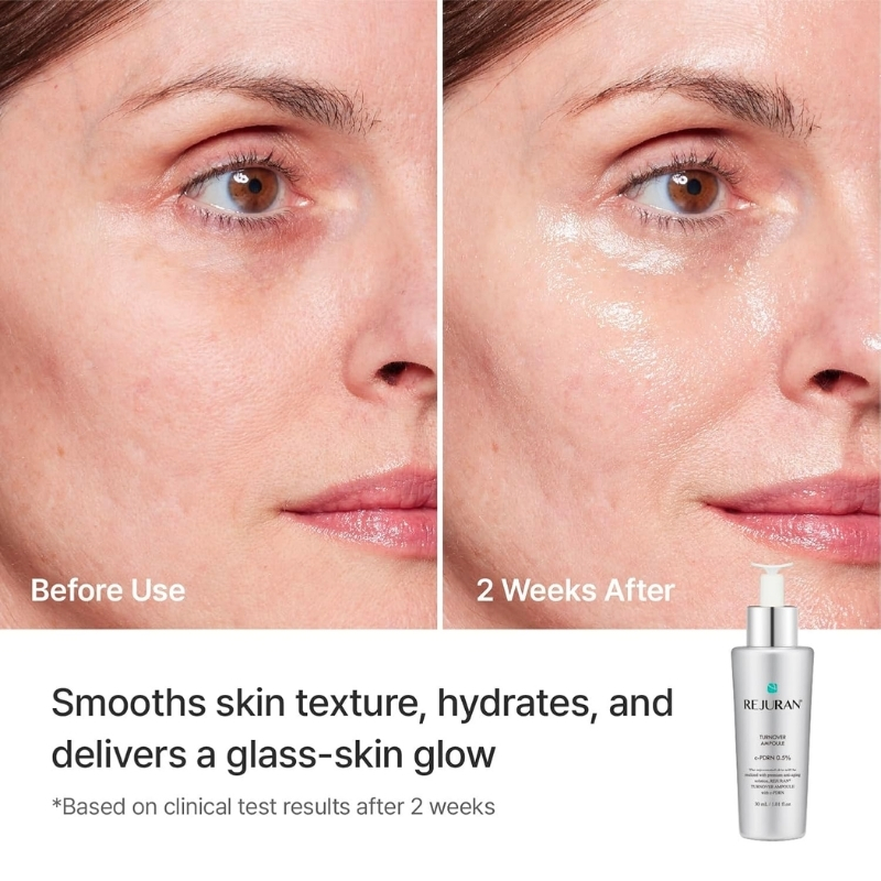 Side-by-side comparison: left shows before use with dull, dry skin; right shows 2 weeks after treatment with smooth, hydrated glow (serum bottle visible).