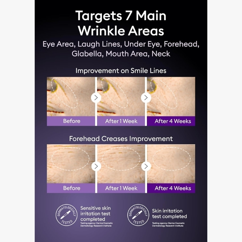 Infographic: seven wrinkle targets (eye area, laugh lines, under eye, forehead, glabella, mouth, neck) with before/after photos (1 & 4 weeks).