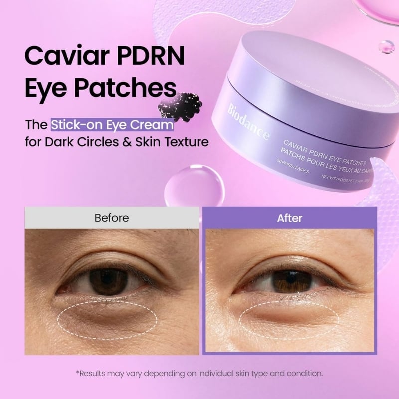 Advertising image for Caviar PDRN Eye Patches showing a purple jar and before/after under-eye photos on pink background.