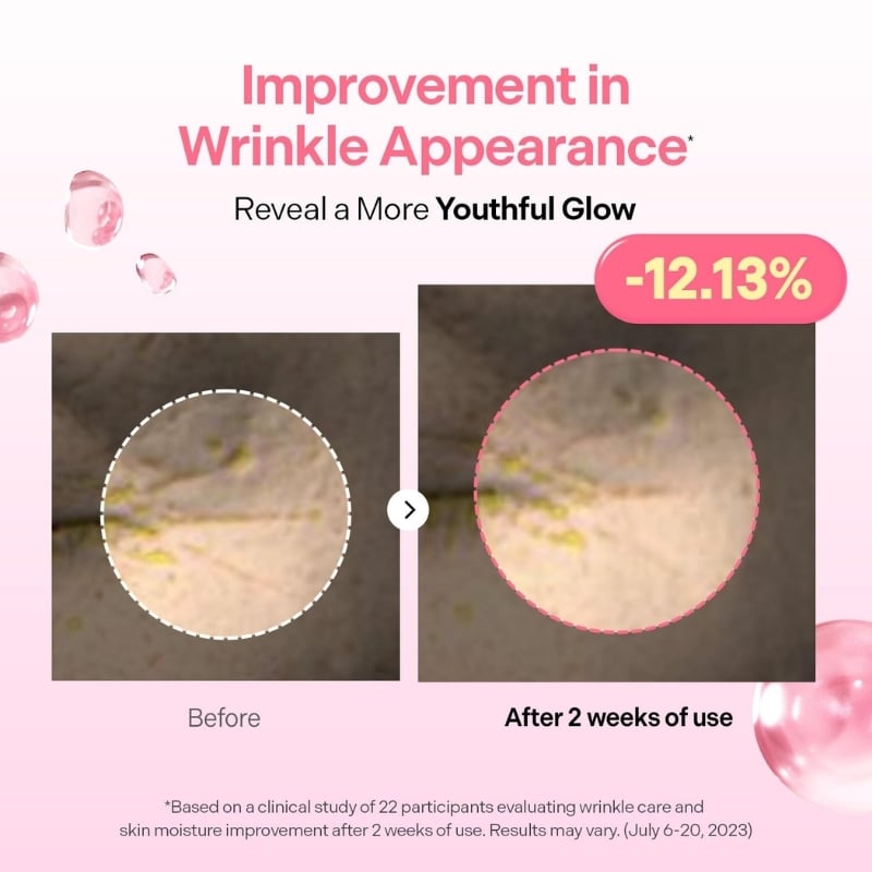Before/after comparison of wrinkle treatment: left 'Before' with a white dotted circle, right 'After 2 weeks of use' with a pink dotted circle and a -12.13% badge.