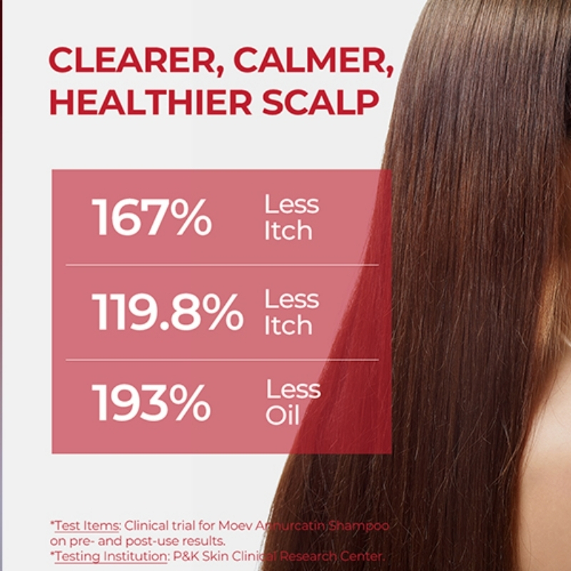Ad claiming a clearer, calmer, healthier scalp with percentages for less itch and less oil, showing hair on the right.