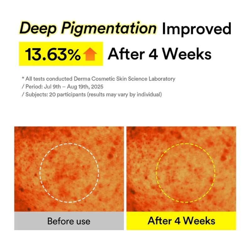 Infographic showing 13.63% improvement in deep pigmentation after 4 weeks, with before and after skin images highlighted by circles.
