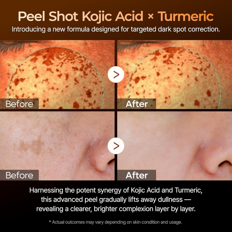 Dr. Melaxin - Peel Shot Exfoliating Kojic Acid Turmeric Serum (80ml) - Image 4
