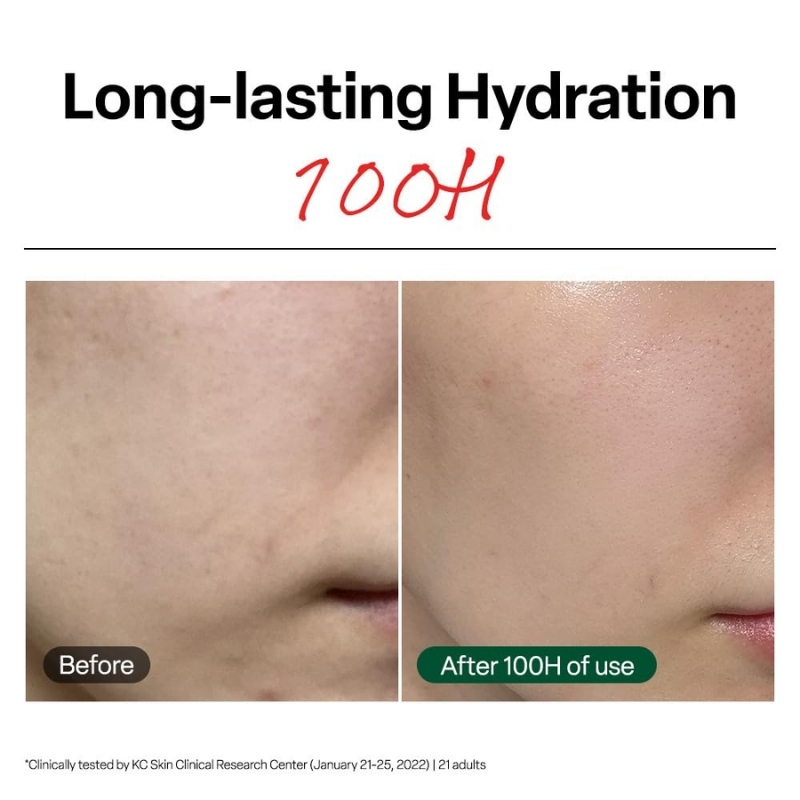 R.E.D Blemish Clear Soothing Cream (70ml) - Image 6